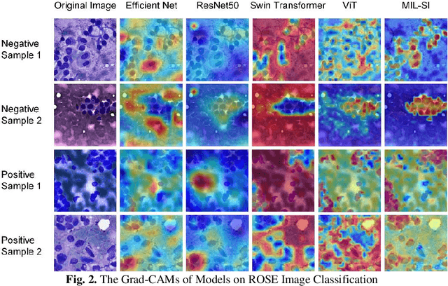 Figure 3 for Pancreatic Cancer ROSE Image Classification Based on Multiple Instance Learning with Shuffle Instances