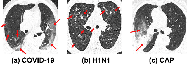 Figure 1 for M3Lung-Sys: A Deep Learning System for Multi-Class Lung Pneumonia Screening from CT Imaging