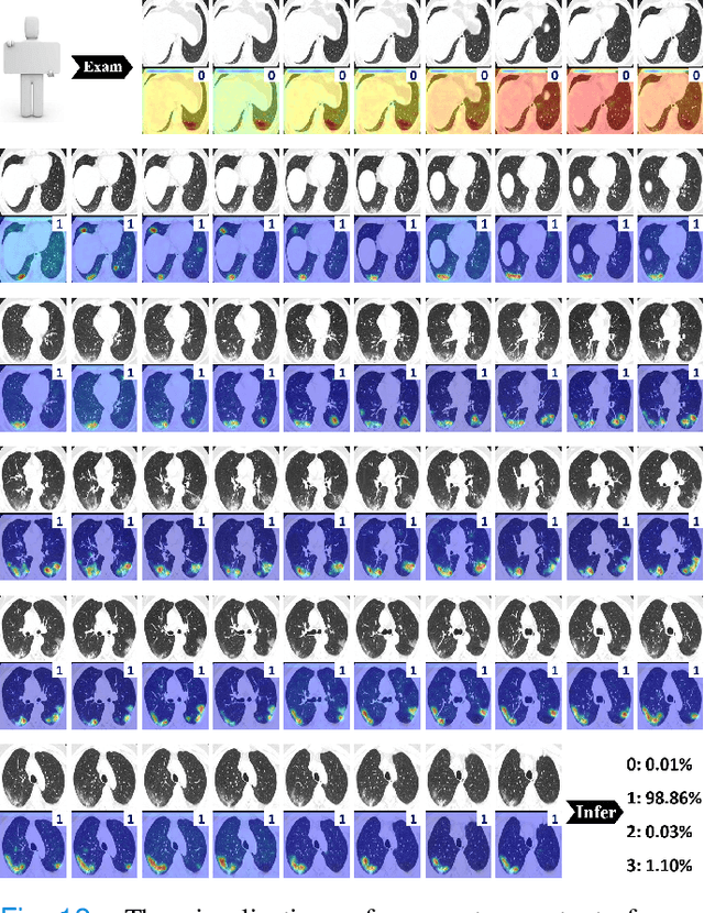 Figure 4 for M3Lung-Sys: A Deep Learning System for Multi-Class Lung Pneumonia Screening from CT Imaging