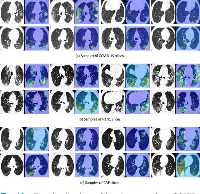 Figure 2 for M3Lung-Sys: A Deep Learning System for Multi-Class Lung Pneumonia Screening from CT Imaging