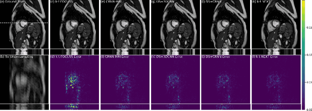 Figure 3 for k-t NEXT: Dynamic MR Image Reconstruction Exploiting Spatio-temporal Correlations