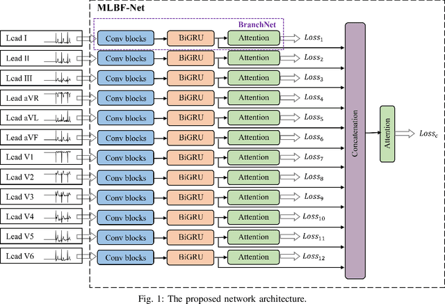Figure 1 for MLBF-Net: A Multi-Lead-Branch Fusion Network for Multi-Class Arrhythmia Classification Using 12-Lead ECG