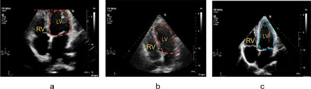 Figure 2 for Automated Assessment of Transthoracic Echocardiogram Image Quality Using Deep Neural Networks