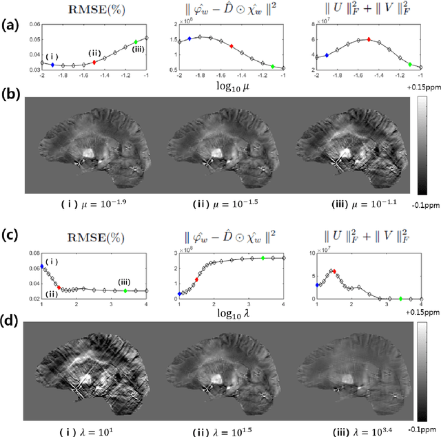 Figure 3 for Quantitative Susceptibility Map Reconstruction Using Annihilating Filter-based Low-Rank Hankel Matrix Approach
