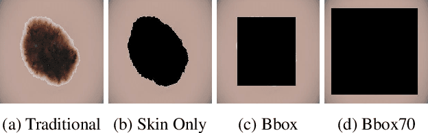 Figure 1 for Debiasing Skin Lesion Datasets and Models? Not So Fast