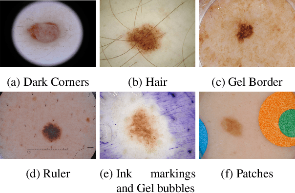 Figure 3 for Debiasing Skin Lesion Datasets and Models? Not So Fast