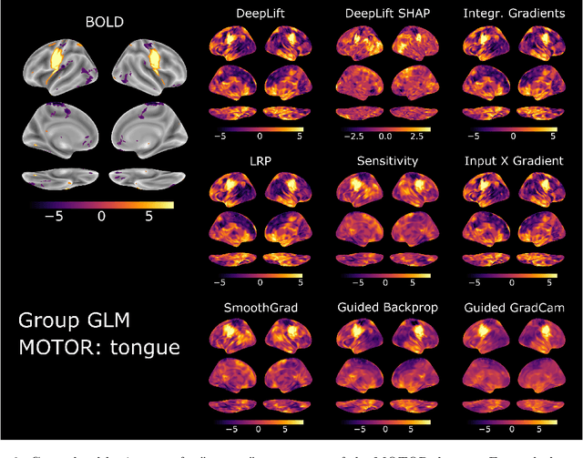 Figure 2 for Comparing interpretation methods in mental state decoding analyses with deep learning models