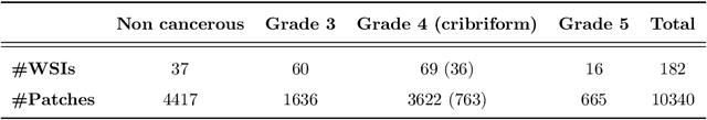 Figure 2 for Going Deeper through the Gleason Scoring Scale: An Automatic end-to-end System for Histology Prostate Grading and Cribriform Pattern Detection