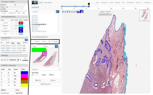 Figure 2 for EXACT: A collaboration toolset for algorithm-aided annotation of almost everything