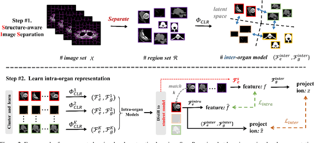 Figure 3 for Separated Contrastive Learning for Organ-at-Risk and Gross-Tumor-Volume Segmentation with Limited Annotation