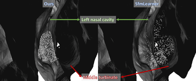 Figure 3 for Self-supervised Learning for Dense Depth Estimation in Monocular Endoscopy