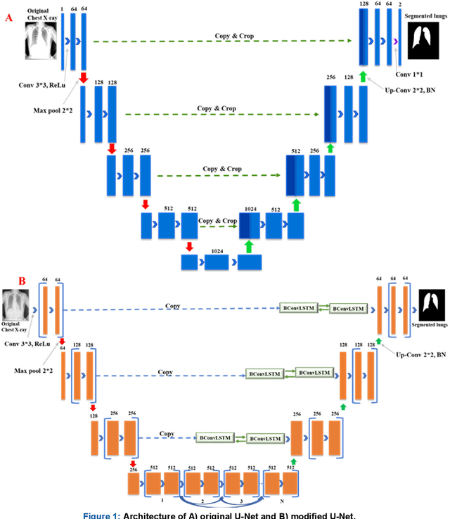 Figure 1 for Reliable Tuberculosis Detection using Chest X-ray with Deep Learning, Segmentation and Visualization