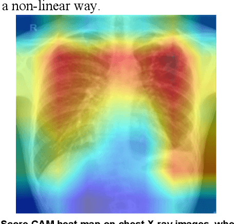 Figure 3 for Reliable Tuberculosis Detection using Chest X-ray with Deep Learning, Segmentation and Visualization