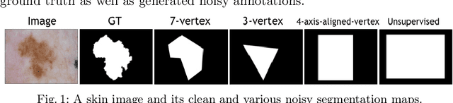 Figure 1 for Learning to Segment Skin Lesions from Noisy Annotations