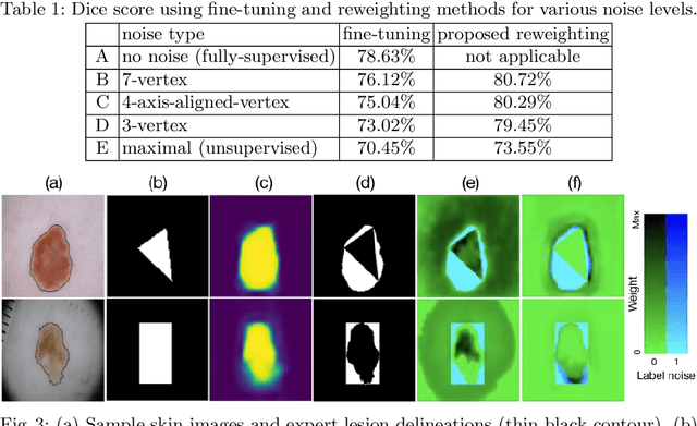 Figure 2 for Learning to Segment Skin Lesions from Noisy Annotations