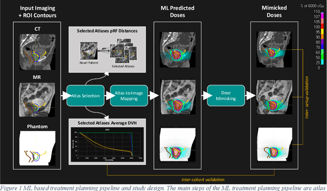 Figure 1 for Domain Adaptation of Automated Treatment Planning from Computed Tomography to Magnetic Resonance