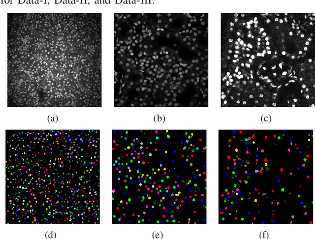 Figure 3 for Center-Extraction-Based Three Dimensional Nuclei Instance Segmentation of Fluorescence Microscopy Images