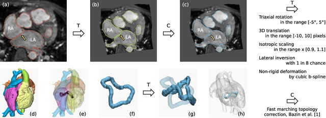 Figure 2 for Topology-preserving augmentation for CNN-based segmentation of congenital heart defects from 3D paediatric CMR