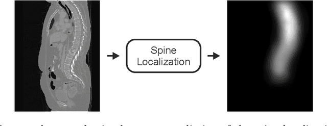 Figure 3 for VerSe: A Vertebrae Labelling and Segmentation Benchmark