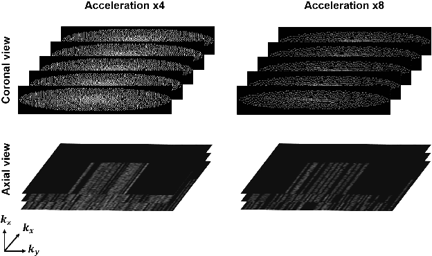 Figure 3 for Two-Stage Deep Learning for Accelerated 3D Time-of-Flight MRA without Matched Training Data