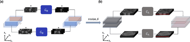 Figure 4 for Two-Stage Deep Learning for Accelerated 3D Time-of-Flight MRA without Matched Training Data