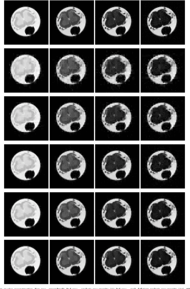 Figure 2 for Multi-echo Reconstruction from Partial K-space Scans via Adaptively Learnt Basis