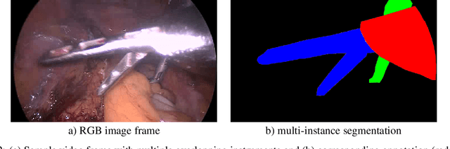 Figure 3 for How can we learn  from challenges? A statistical approach to driving future algorithm development