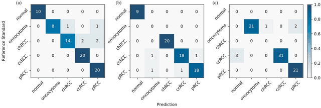 Figure 4 for Development and Evaluation of a Deep Neural Network for Histologic Classification of Renal Cell Carcinoma on Biopsy and Surgical Resection Slides