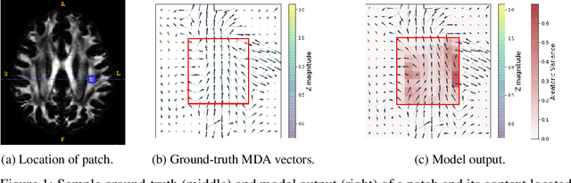 Figure 1 for Estimating localized complexity of white-matter wiring with GANs