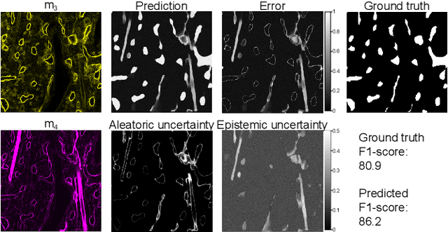 Figure 4 for Utilizing Uncertainty Estimation in Deep Learning Segmentation of Fluorescence Microscopy Images with Missing Markers