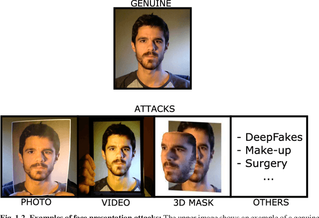 Figure 3 for Introduction to Presentation Attack Detection in Iris Biometrics and Recent Advances