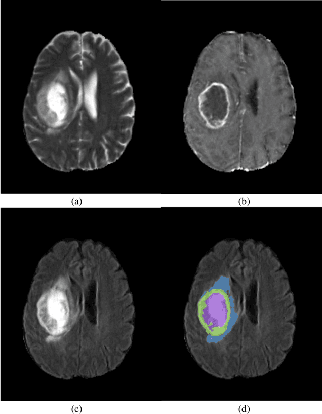 Figure 1 for Ensemble CNN Networks for GBM Tumors Segmentation using Multi-parametric MRI