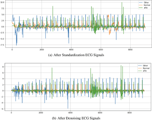 Figure 1 for Atrial Fibrillation Detection and ECG Classification based on CNN-BiLSTM