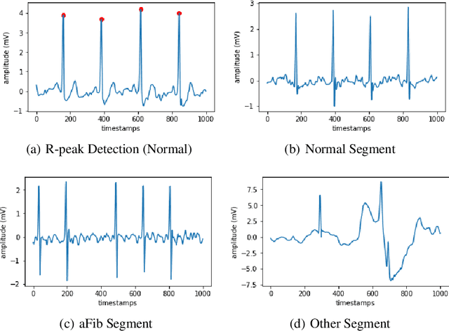 Figure 2 for Atrial Fibrillation Detection and ECG Classification based on CNN-BiLSTM