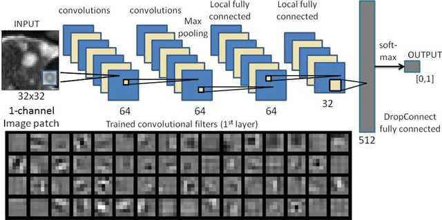 Figure 3 for Detection of Sclerotic Spine Metastases via Random Aggregation of Deep Convolutional Neural Network Classifications