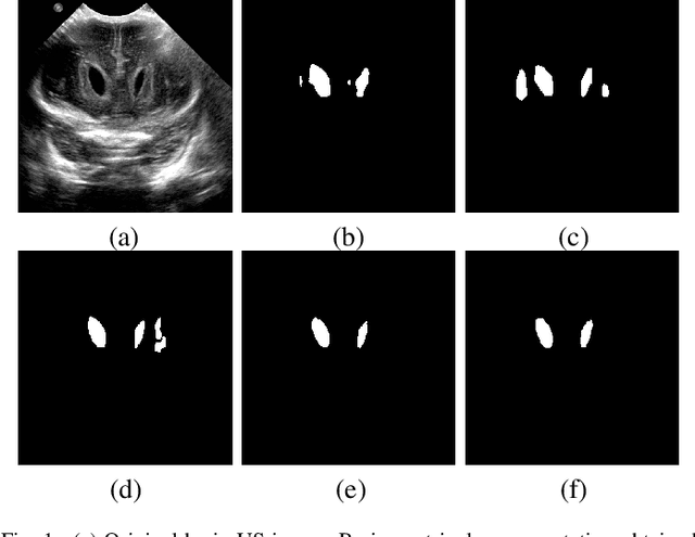 Figure 1 for Learning to Segment Brain Anatomy from 2D Ultrasound with Less Data