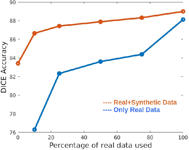 Figure 2 for Learning to Segment Brain Anatomy from 2D Ultrasound with Less Data