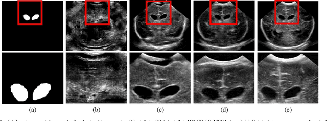 Figure 3 for Learning to Segment Brain Anatomy from 2D Ultrasound with Less Data