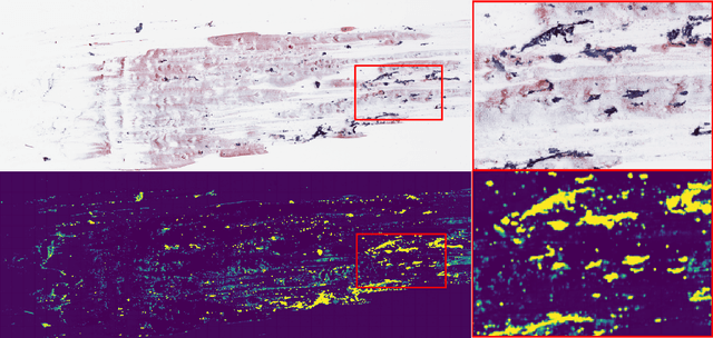 Figure 3 for Thyroid Cancer Malignancy Prediction From Whole Slide Cytopathology Images