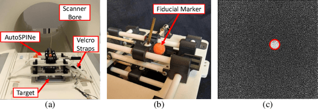 Figure 2 for Resolution-Enhanced MRI-Guided Navigation of Spinal Cellular Injection Robot