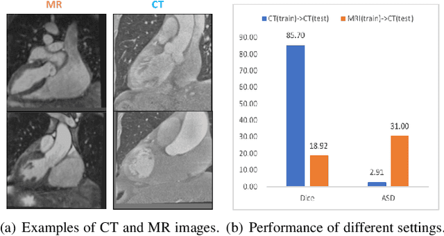 Figure 1 for Deep Symmetric Adaptation Network for Cross-modality Medical Image Segmentation