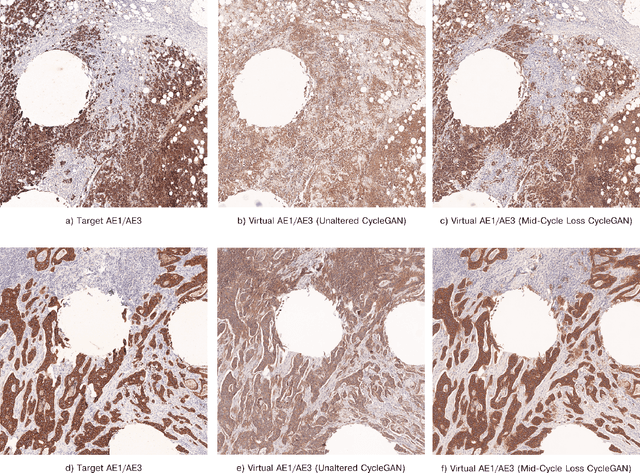 Figure 4 for Ensuring accurate stain reproduction in deep generative networks for virtual immunohistochemistry