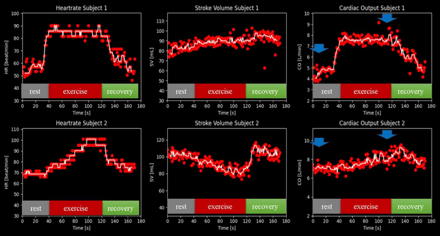 Figure 3 for FReSCO: Flow Reconstruction and Segmentation for low latency Cardiac Output monitoring using deep artifact suppression and segmentation