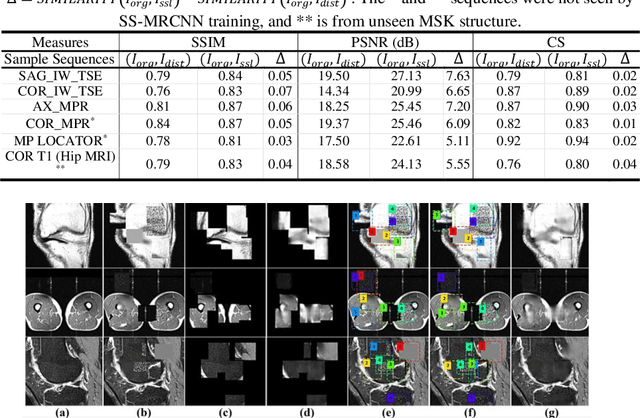 Figure 3 for Self-Supervised-RCNN for Medical Image Segmentation with Limited Data Annotation