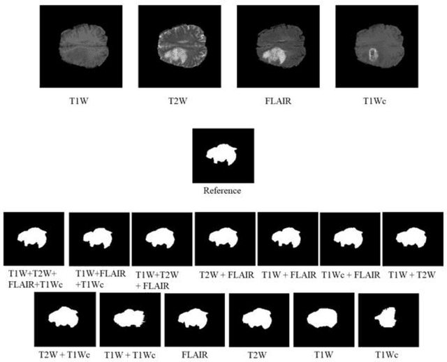 Figure 1 for Joint brain tumor segmentation from multi MR sequences through a deep convolutional neural network
