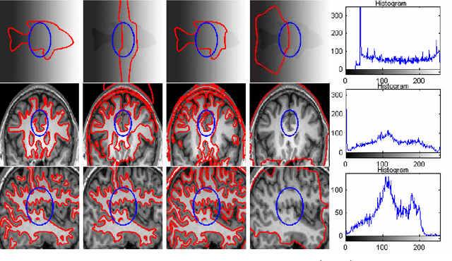 Figure 3 for A Local Active Contour Model for Image Segmentation with Intensity Inhomogeneity