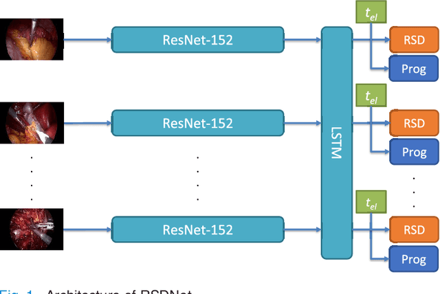 Figure 1 for RSDNet: Learning to Predict Remaining Surgery Duration from Laparoscopic Videos Without Manual Annotations