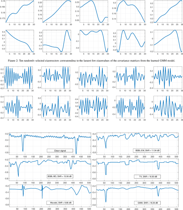 Figure 4 for Compressive Sensing of ECG Signals using Plug-and-Play Regularization