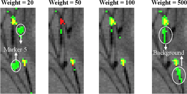 Figure 4 for Towards Automatic 3D Shape Instantiation for Deployed Stent Grafts: 2D Multiple-class and Class-imbalance Marker Segmentation with Equally-weighted Focal U-Net