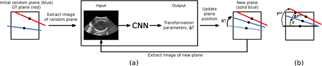 Figure 1 for Standard Plane Detection in 3D Fetal Ultrasound Using an Iterative Transformation Network